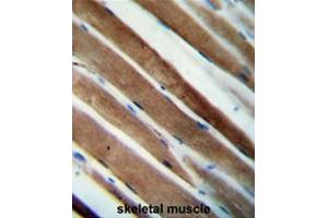 CCDC38 Antibody (Center) immunohistochemistry analysis in formalin fixed and paraffin embedded human skeletal muscle followed by peroxidase conjugation of the secondary antibody and DAB staining. (CCDC38 anticorps  (Middle Region))