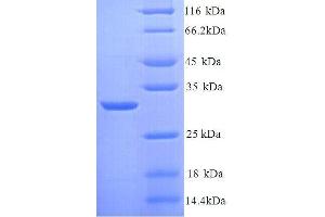 Kininogen 1 (KNG1) (AA 390-639), (full length) protein (His tag) (KNG1 Protein (AA 390-639, full length) (His tag))