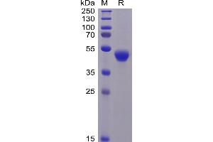 Human CD5 Protein, His Tag on SDS-PAGE under reducing condition. (CD5 Protein (CD5) (AA 25-372) (His tag))