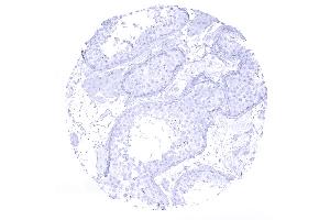 testis (Recombinant Cytokeratin 7 anticorps  (AA 1-100))