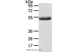 Western blot analysis of Mouse plasma tissue , using AGPAT6  Polyclonal Antibody at dilution of 1:400 (AGPAT6 anticorps)