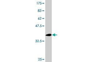 Western Blot detection against Immunogen (36. (Nicastrin anticorps  (AA 16-115))