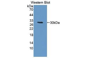 Western blot analysis of the recombinant protein. (PRKDC anticorps  (AA 3899-4128))