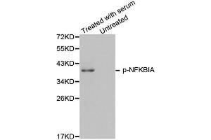 Western Blotting (WB) image for anti-Nuclear Factor of kappa Light Polypeptide Gene Enhancer in B-Cells Inhibitor, alpha (NFKBIA) (pTyr42) antibody (ABIN1870480) (NFKBIA anticorps  (pTyr42))