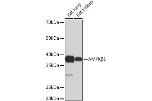 Western blot analysis of extracts of various cell lines, using AMPKβ1 Rabbit mAb (ABIN7269654) at 1:1000 dilution. (PRKAB1 anticorps)