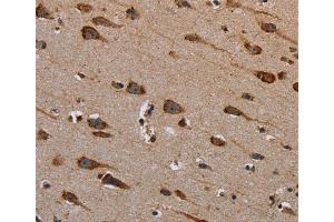 Immunohistochemistry (IHC) image for anti-Plexin B1 (PLXNB1) antibody (ABIN2435216) (PLXNB1 anticorps)