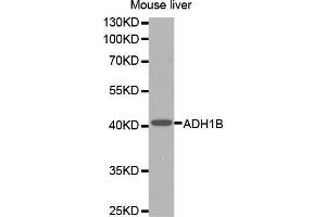 Western Blotting (WB) image for anti-Alcohol Dehydrogenase 1B (Class I), beta Polypeptide (ADH1B) (AA 206-375) antibody (ABIN6218524) (ADH1B anticorps  (AA 206-375))