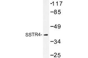 Image no. 1 for anti-Somatostatin Receptor 4 (SSTR4) antibody (ABIN317867) (SSTR4 anticorps)