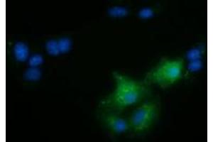 Anti-FAM84B mouse monoclonal antibody (ABIN2453030) immunofluorescent staining of COS7 cells transiently transfected by pCMV6-ENTRY FAM84B (RC207996). (FAM84B anticorps)