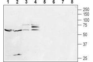 Western blot analysis of mouse brain (lanes 1 and 5), rat brain (lanes 2 and 6), rat uterus (lanes 3 and 7) and SH-SY5Y cell (lanes 4 and 8) lysates: - 1-4. (Serotonin Receptor 2B anticorps  (Extracellular, N-Term))