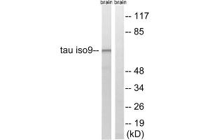 Western blot analysis of extracts from rat brain cells, using Tau (epitope around residue 534/217) antibody. (tau anticorps  (Thr217, Thr534))