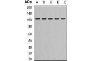 Western blot analysis of DNA Ligase 3 expression in Jurkat (A), NIH3T3 (B), MCF7 (C), PC3 (D), Hela (E) whole cell lysates. (LIG3 anticorps)
