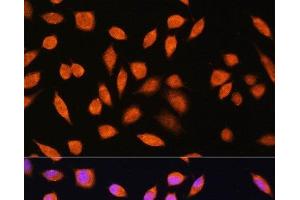 Immunofluorescence analysis of L929 cells using PNPO Polyclonal Antibody at dilution of 1:100. (PNPO anticorps)