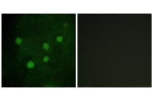 Immunofluorescence analysis of HUVEC cells, using BAF250B antibody. (ARID1B anticorps  (Internal Region))