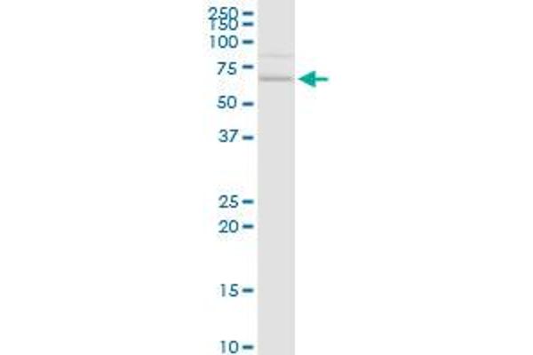 CACNB3 anticorps  (AA 1-484)