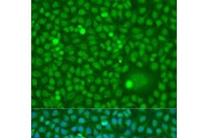 Immunofluorescence analysis of U2OS cells using CDK10 Polyclonal Antibody at dilution of 1:100. (CDK10 anticorps)