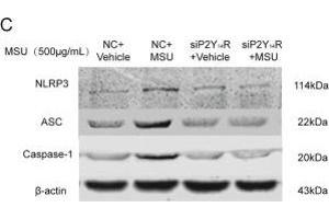 Western Blotting (WB) image for anti-Steroid Sulfatase (STS) antibody (ABIN2170333)