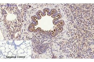 Immunohistochemical analysis of paraffin-embedded rat lung tissue. (PI3K p85 alpha/gamma anticorps)