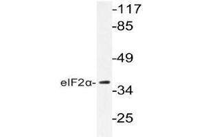 Western blot (WB) analyzes of eIF2alpha antibody in extracts from K562 cells. (EIF2S1 anticorps)