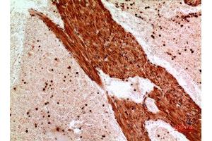 Immunohistochemistry (IHC) analysis of paraffin-embedded Mouse Heart, antibody was diluted at 1:100. (ANGPTL1 anticorps  (Internal Region))