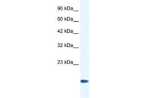 WB Suggested Anti-CSRP3 Antibody Titration:  0. (CSRP3 anticorps  (Middle Region))
