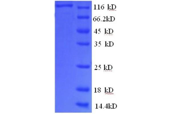 PYGB Protein (AA 6-843, partial) (GST tag)