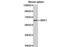 Western Blotting (WB) image for anti-G Protein-Coupled Receptor Kinase 1 (GRK1) antibody (ABIN1872898) (GRK1 anticorps)