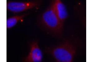 Immunofluorescence (IF) image for anti-zeta-Chain (TCR) Associated Protein Kinase 70kDa (ZAP70) (pTyr319) antibody (ABIN1682143) (ZAP70 anticorps  (pTyr319))
