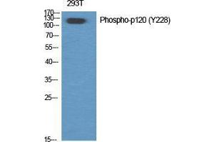 Western Blot (WB) analysis of specific cells using Phospho-p120 (Y228) Polyclonal Antibody. (CTNND1 anticorps  (pTyr228))