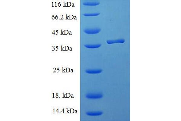 ICT1 Protein (AA 30-206) (His-SUMO Tag)