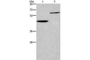 Western Blot analysis of Human hepatocellular carcinoma tissue and Jurkat cell using DOK1 Polyclonal Antibody at dilution of 1:450 (DOK1 anticorps)