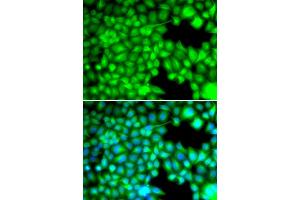 Immunofluorescence analysis of U2OS cells using FABP3 antibody (ABIN5973057). (FABP3 anticorps)