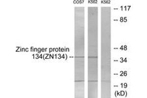 Western Blotting (WB) image for anti-Zinc Finger Protein 134 (ZNF134) (AA 116-165) antibody (ABIN2889510) (ZNF134 anticorps  (AA 116-165))