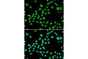 Immunofluorescence analysis of A549 cells using GTF2F2 antibody (ABIN5973440). (GTF2F2 anticorps)