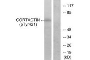 Western Blotting (WB) image for anti-Cortactin (CTTN) (pTyr421) antibody (ABIN2888388) (Cortactin anticorps  (pTyr421))