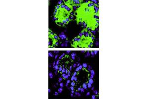 Immunohistochemical staining. (IL-18 anticorps)