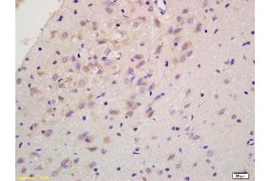 Formalin-fixed and paraffin embedded rat brain labeled with Anti-RGS2 Polyclonal Antibody, Unconjugated (ABIN669291) at 1:200 followed by conjugation to the secondary antibody and DAB staining. (RGS2 anticorps  (AA 116-211))