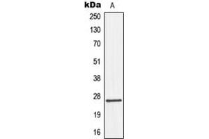 Western blot analysis of Connexin 26 expression in HepG2 (A) whole cell lysates. (GJB2 anticorps  (Center))