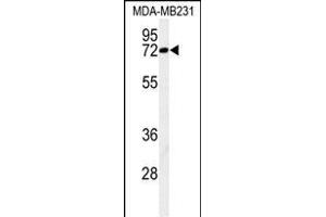 Western blot analysis of C Antibody (N-term) (ABIN650926 and ABIN2839997) in MDA-M cell line lysates (35 μg/lane). (CJ119 (AA 143-171), (N-Term) anticorps)