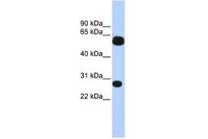 Image no. 1 for anti-Tripartite Motif Containing 16 (TRIM16) (AA 36-85) antibody (ABIN6742603) (TRIM16 anticorps  (AA 36-85))