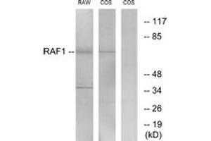 Western blot analysis of extracts from RAW264. (RAF1 anticorps  (AA 305-354))