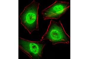 Fluorescent image of Hela cells stained with GTF2I Antibody (C-term) (ABIN390868 and ABIN2841085). (GTF2I anticorps  (C-Term))