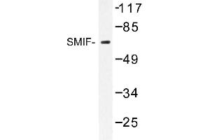 Image no. 1 for anti-DCP1 Decapping Enzyme Homolog A (S. Cerevisiae) (DCP1A) antibody (ABIN272254) (DCP1A anticorps)