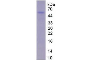 SDS-PAGE of Protein Standard from the Kit (Highly purified E. (Fibrinogen beta Chain Kit ELISA)