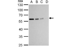 Western Blotting (WB) image for anti-Vimentin (VIM) antibody (ABIN2854814)