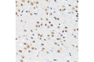 Immunohistochemistry of paraffin-embedded rat brain using Cullin 3 antibody (ABIN7266543) at dilution of 1:100 (40x lens). (Cullin 3 anticorps)