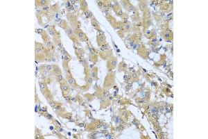 Immunohistochemistry of paraffin-embedded human stomach using STX7 antibody (ABIN5974647) at dilution of 1/100 (40x lens). (Syntaxin 7 anticorps)