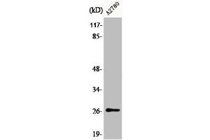 Western Blot analysis of COLO205 cells using Phospho-p27 (S10) Polyclonal Antibody (CDKN1B anticorps  (pSer10))