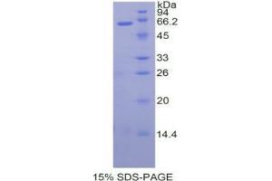 SDS-PAGE analysis of Human TFPI Protein. (TFPI Protéine)