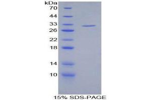 SDS-PAGE (SDS) image for Filamin C, gamma (FLNC) (AA 17-259) protein (His tag) (ABIN2124848) (FLNC Protein (AA 17-259) (His tag))